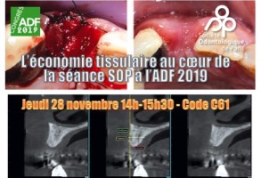 La SOP au congrès de l'ADF 2019